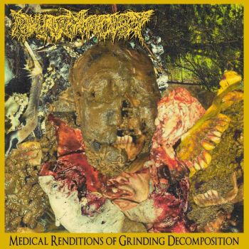Medical Renditions Of Grinding Decomposition