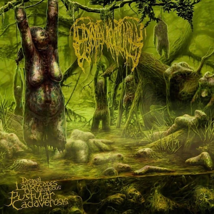 Epicardiectomy - Dismal Landscapes Of Voluptuous Pustular Cadaverosis Epicardiectomy - Dismal Landscapes Of Voluptuous Pustular Cadaverosis